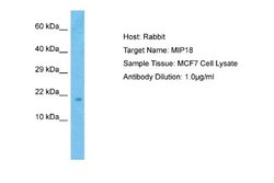CGI-128 Rabbit anti-Human, Polyclonal, Novus Biologicals 0.1ml; Unconjugated:Antibodies,